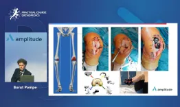 Knee arthroplasty: hot topics