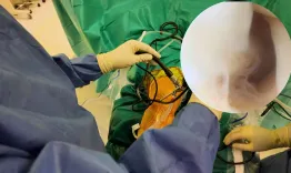 Knee exploratory arthroscopy